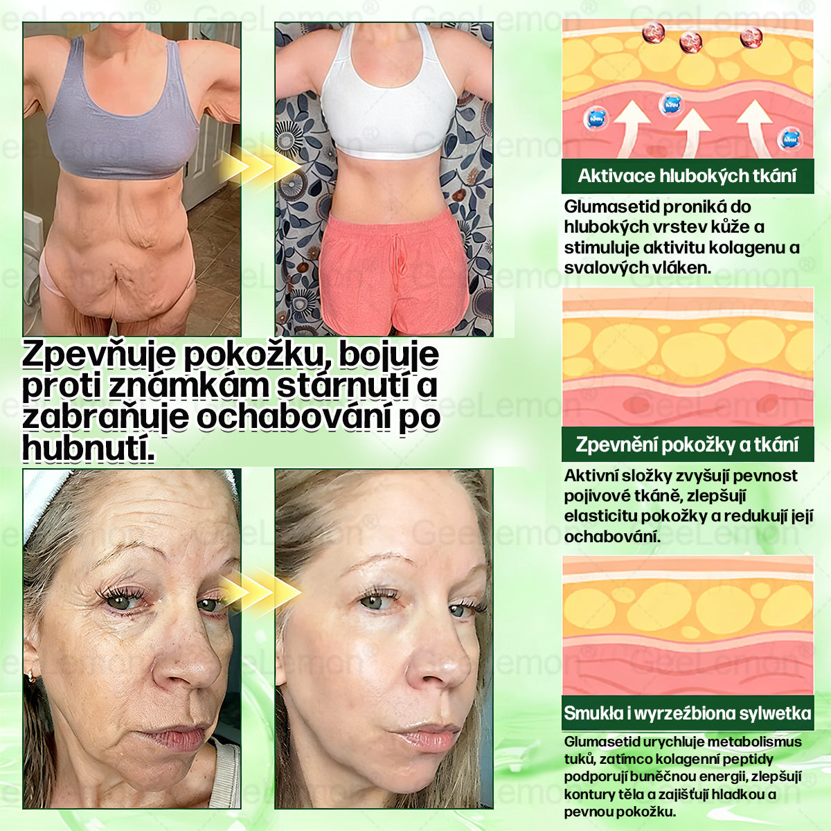 🔥👨‍⚕️Doporučeno Fakultní nemocnicí Motol · 👩‍⚕️ Oficiální prodejna BENU | 🎁 𝐆𝐞𝑒𝑙𝑒𝐦𝐨𝐧® Glum𝐚𝐬𝐞tide 8 v 1 – Zeštíhlující nano mikrojihlový náplast 🇨🇿 Jen 1× denně ✅ Viditelné změny za 7 dní – na obezitu, kardiovaskulární zdraví, diabetes a kloubní problémy