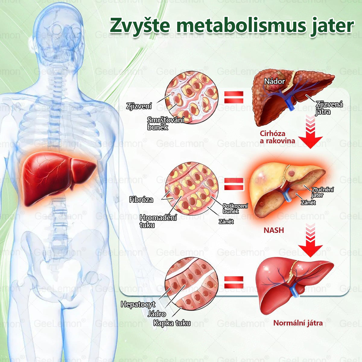 🔥👨‍⚕️Doporučeno Fakultní nemocnicí Motol · 👩‍⚕️ Oficiální prodejna BENU | 🎁 𝐆𝐞𝑒𝑙𝑒𝐦𝐨𝐧® Glum𝐚𝐬𝐞tide 8 v 1 – Zeštíhlující nano mikrojihlový náplast 🇨🇿 Jen 1× denně ✅ Viditelné změny za 7 dní – na obezitu, kardiovaskulární zdraví, diabetes a kloubní problémy