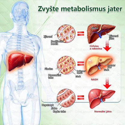 🔥👨‍⚕️Doporučeno Fakultní nemocnicí Motol · 👩‍⚕️ Oficiální prodejna BENU | 🎁 𝐆𝐞𝑒𝑙𝑒𝐦𝐨𝐧® Glum𝐚𝐬𝐞tide 8 v 1 – Zeštíhlující nano mikrojihlový náplast 🇨🇿 Jen 1× denně ✅ Viditelné změny za 7 dní – na obezitu, kardiovaskulární zdraví, diabetes a kloubní problémy
