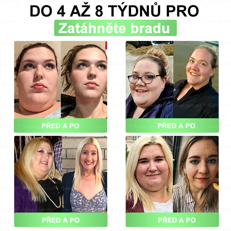 🔥👨‍⚕️Doporučeno Fakultní nemocnicí Motol · 👩‍⚕️ Oficiální prodejna BENU | 🎁 𝐆𝐞𝑒𝑙𝑒𝐦𝐨𝐧® Glum𝐚𝐬𝐞tide 8 v 1 – Zeštíhlující nano mikrojihlový náplast 🇨🇿 Jen 1× denně ✅ Viditelné změny za 7 dní – na obezitu, kardiovaskulární zdraví, diabetes a kloubní problémy