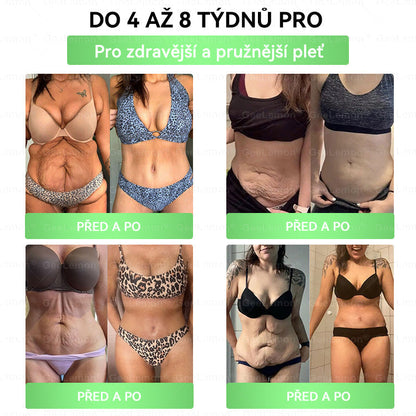 🔥👨‍⚕️Doporučeno Fakultní nemocnicí Motol · 👩‍⚕️ Oficiální prodejna BENU | 🎁 𝐆𝐞𝑒𝑙𝑒𝐦𝐨𝐧® Glum𝐚𝐬𝐞tide 8 v 1 – Zeštíhlující nano mikrojihlový náplast 🇨🇿 Jen 1× denně ✅ Viditelné změny za 7 dní – na obezitu, kardiovaskulární zdraví, diabetes a kloubní problémy