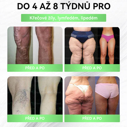 🔥👨‍⚕️Doporučeno Fakultní nemocnicí Motol · 👩‍⚕️ Oficiální prodejna BENU | 🎁 𝐆𝐞𝑒𝑙𝑒𝐦𝐨𝐧® Glum𝐚𝐬𝐞tide 8 v 1 – Zeštíhlující nano mikrojihlový náplast 🇨🇿 Jen 1× denně ✅ Viditelné změny za 7 dní – na obezitu, kardiovaskulární zdraví, diabetes a kloubní problémy